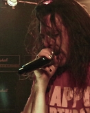 Tinnitus on Jul 30, 2022 [948-small]